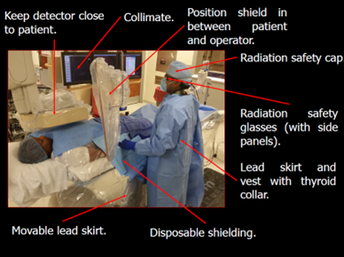 Example of how to position shield between the patient and operator, and additional equipment the operator can wear to protect themselves in interventional radiobiology environments.